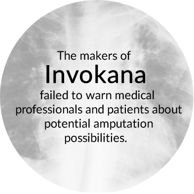 The makers of Invokana failed to warn medical professionals and patients about potential amputation possibilities. 